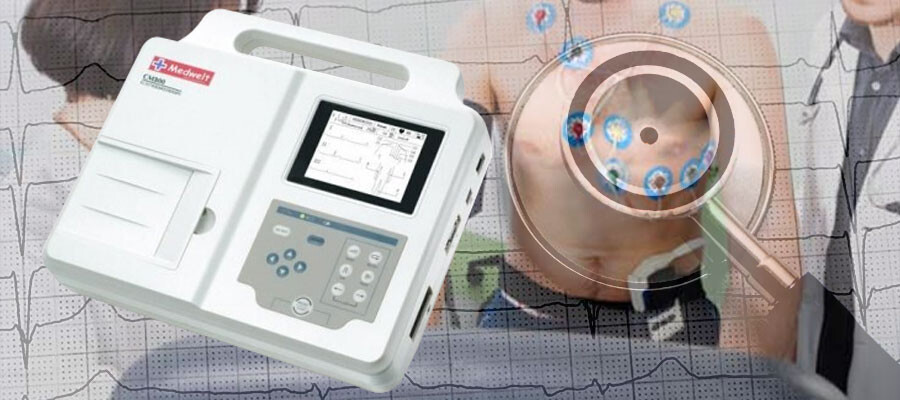 Elektrokardiyogram / EKG Cihazı Nedir?