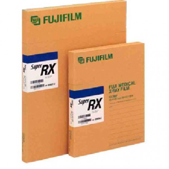 Fujifilm 35X43 Maviye Hassas Röntgen Filmi